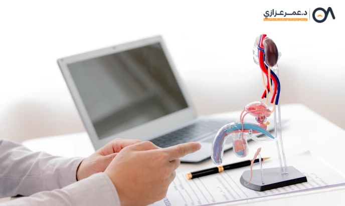 تركيب الدعامة للعضو الذكري