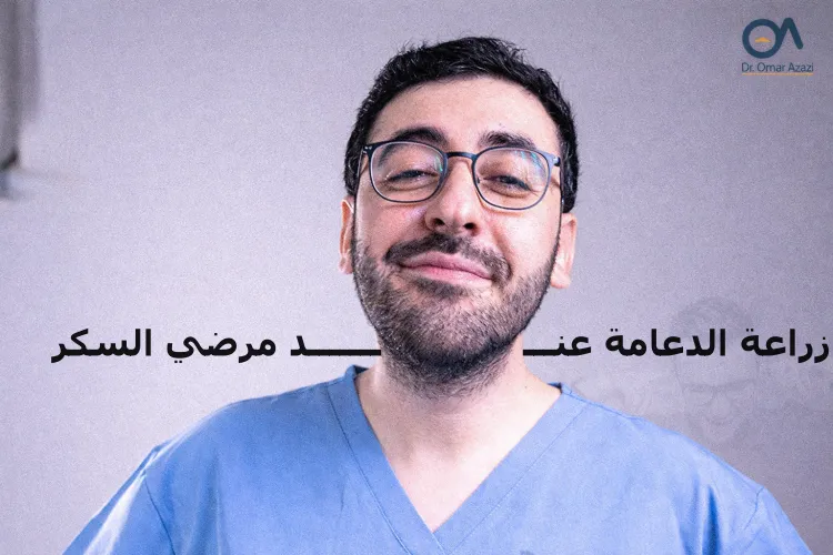 زراعة الدعامة عند مرضي السكر